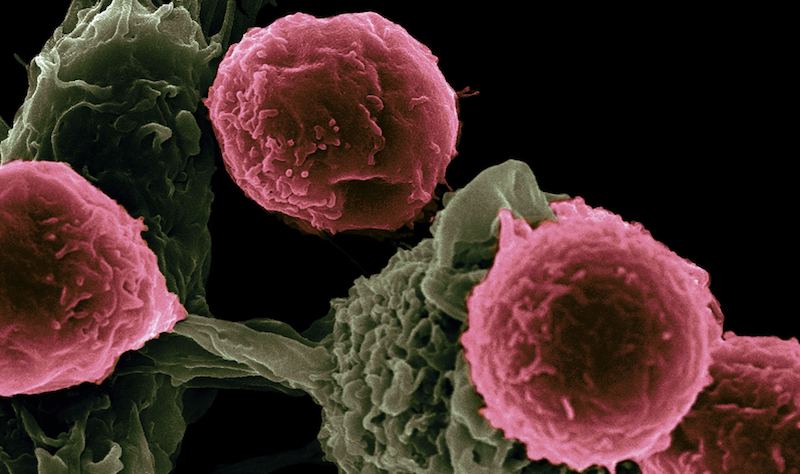 Bei welchen Krebsarten wird dostarlimab eingesetzt? Der einzige Überblick, den Sie brauchen.