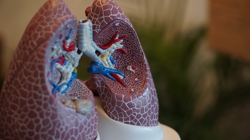 Fruquintinib zur Behandlung von Lungenkrebs: Sind wir schon so weit?