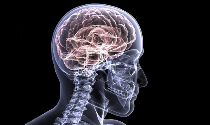 Röntgenbild des menschlichen Gehirns 